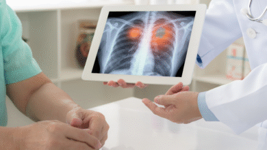 يقوم Thermo Fisher بتطوير اختبار جديد لخزعة زرع الرئة